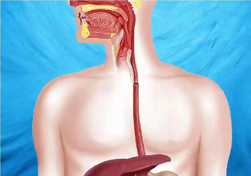 أعراض خفية تكشف دوالي المريء قبل فوات الأوان